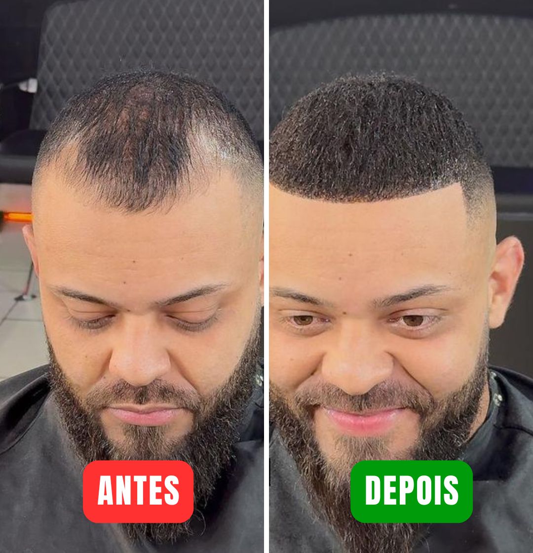 Magic Colour - Elimine a calvície em minutos! (Compre 1 Ganhe 2)